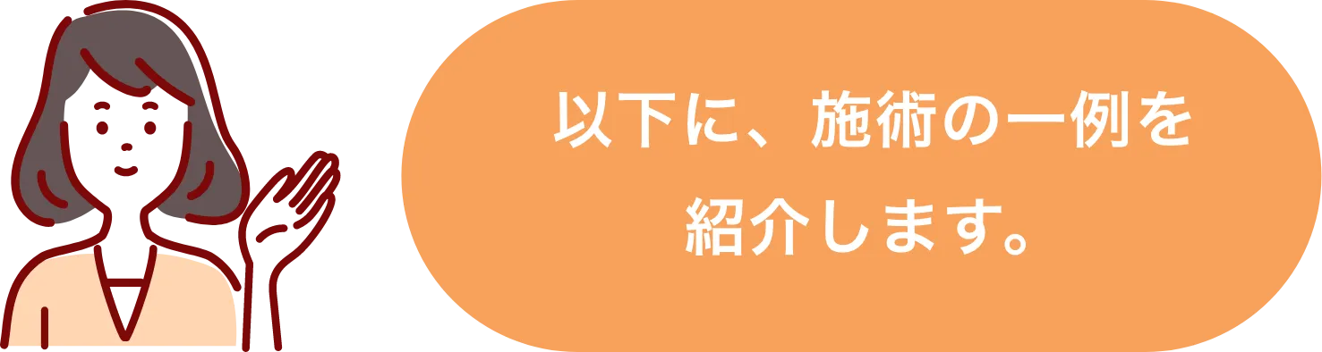 以下に、背術の一例を紹介します