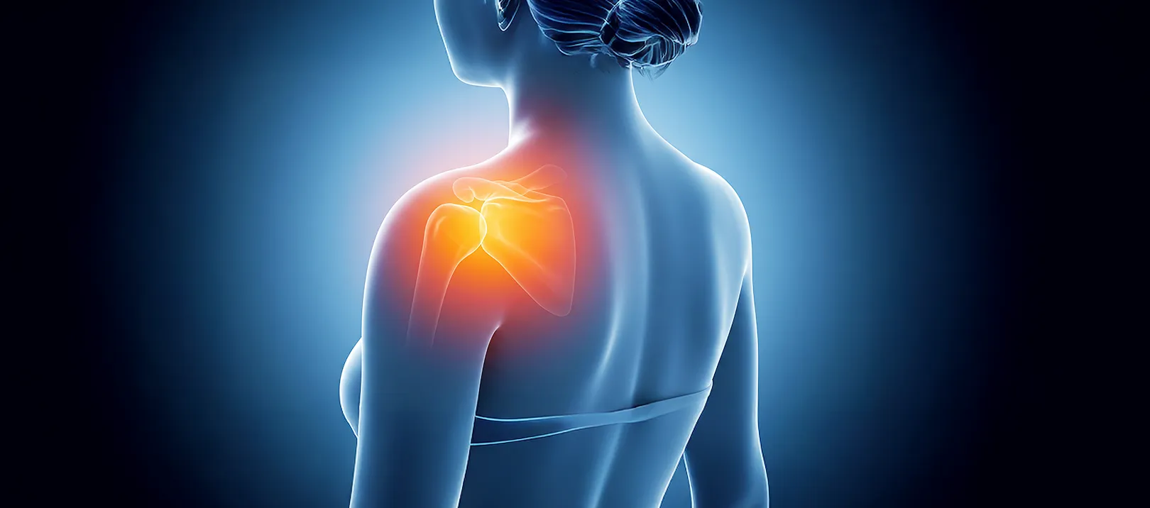 肩の痛みのイメージ